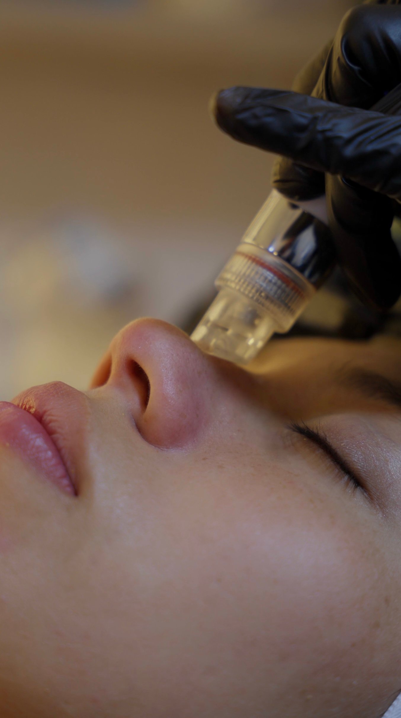 Limpieza del rostro con cabezal de hidrodermoabrasión